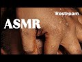 ASMR PIMPLE POPPING SLEEP RELAXATION