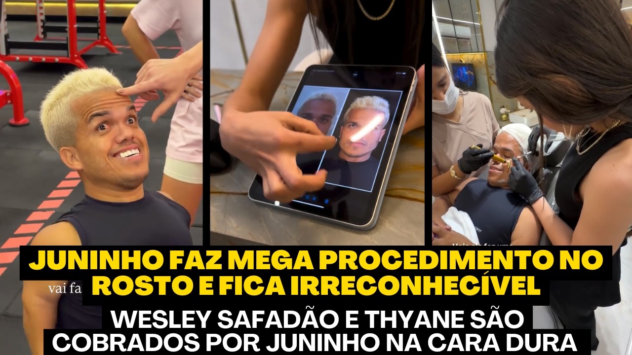 JUNINHO FAZ TRANSFORMAÇÃO QUE SURPREENDEU TODO MUNDO, UM NOVO ANÃO VEM AI - CONFIRA