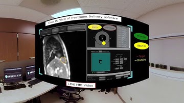 Part 3/3 - Intro to ViewRay MRIdian MR image guided Radiation Treatment (RT) - HFHS Virtual Tour