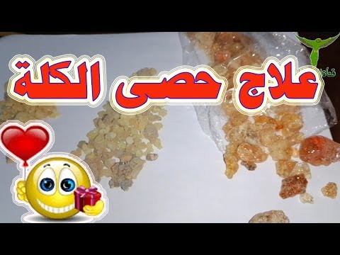 علاج مجرب علاج حصى الكله وتفتيت الحصى من لبان الذكر وعلج المر والصمغ العربي