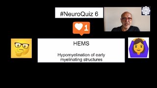 NeuroQuiz 6 - Solution.