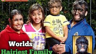 WATCH: Meet world's hairiest family from Mexico