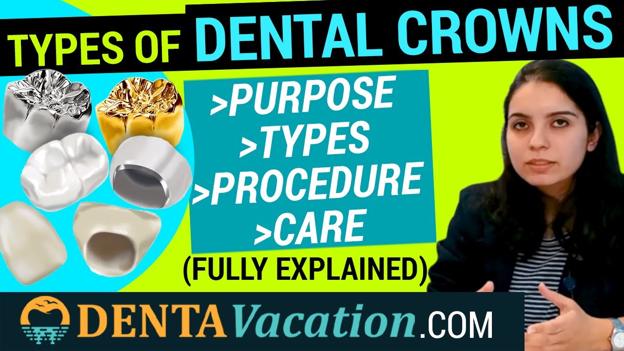 Dental Crowns: Types, Procedure & Care