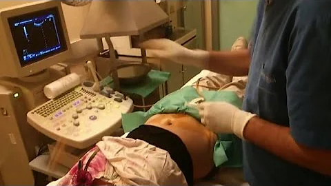 Quali malattie genetiche si vedono con amniocentesi?