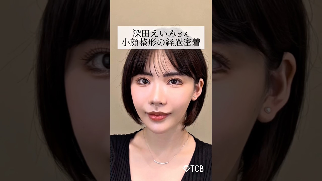 深田 えい み 整形