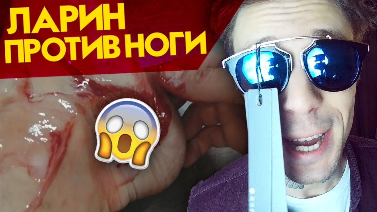 СКАЛЬПЕЛЬ В НОГЕ (ДМТ) РЕАКЦИЯ ДА НИЛ - YouTube