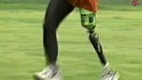High Tech Leg - JVT 1998.4 || Prosthetics || PWD