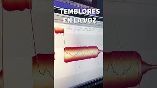 Afinar Voces Débiles