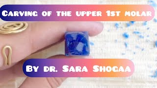 Carving of the upper 1st molar (part 2) by Dr. Sara Shogaa