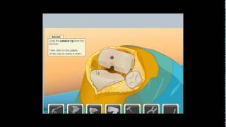 Virtual Knee Surgery