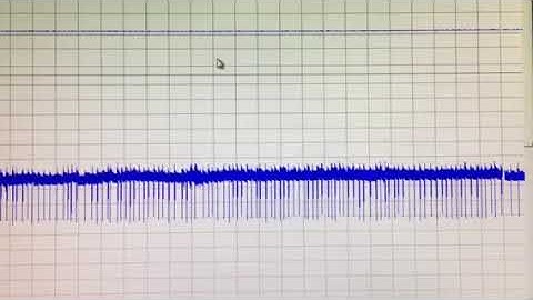 Firing rate of neurons of the NTS