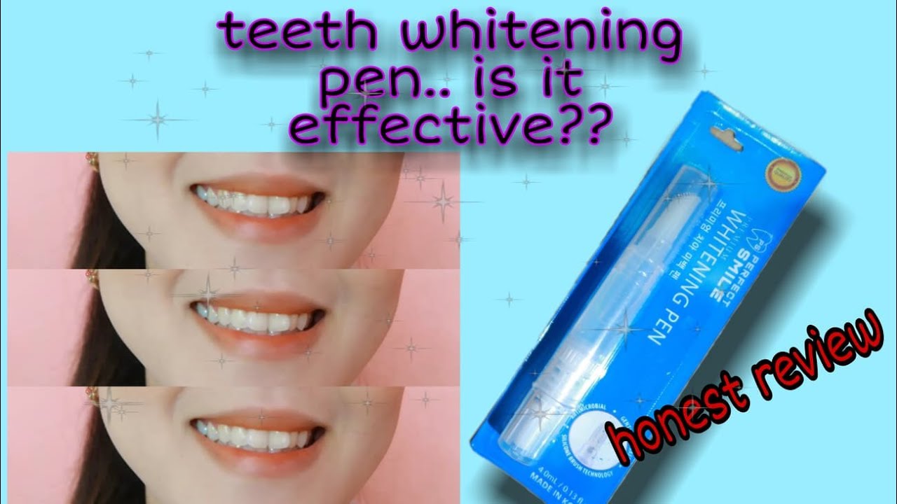 INSTANT TEETH WHITENING PEN | 2 WEEKS REVIEW | IS IT EFFECTIVE??