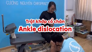 Những Cô Nàng Bị Trật Khớp Cổ Chân #ankledislocation #tratkhopcochan #latbanchan #latcochan #bonggan