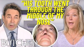 Laura's Dog RIPPED A Giant Hole In Her Nose | Botched | E! Net Worth