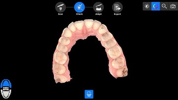 QUADRANT SNAPSHOTS IN CS SCANFLOW