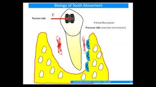 Dental Treatment: Accelerated Orthodontics May 31, 2016