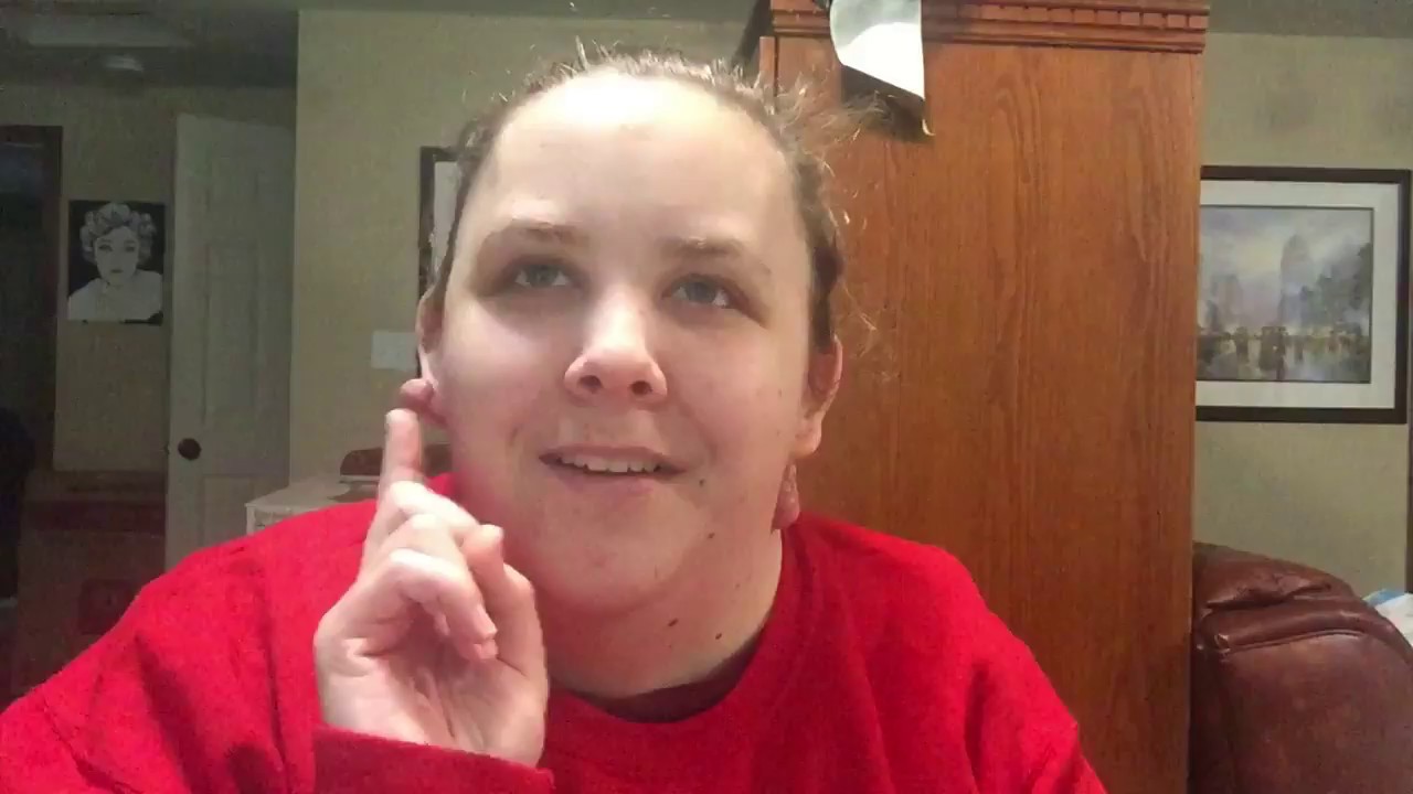 TURNER SYNDROME Hearing Loss Update YouTube