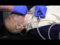 Needle Cricothyrotomy Skill Practice (NRP)