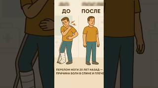 Боль в плече, между лопаток, онемение пальцев рук #реабилитация#екатеринбург