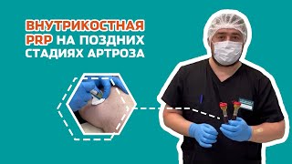 Внутрикостная инъекция против различных видов боли!