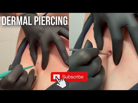 This Is For You If You Want a DERMAL PIERCING! 💎
