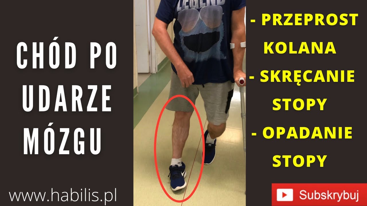 ❗️3 ❗️NAJWAŻNIEJSZE PROBLEMY W CHODZIE PACJENTA PO UDARZE I JAK JE ROZWIĄZAĆ🔥