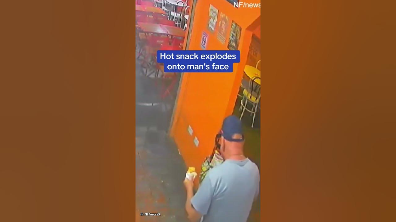 Hot snack explodes onto man’s face