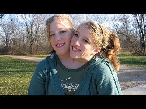 The Fascinating Lives of Conjoined Twins