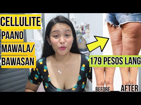 Video: Paano Alisin Ang Labis Na Taba Ng Binti