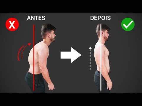 Vídeo: Ombros Arredondados: 4 Correções De Postura Para Tentar