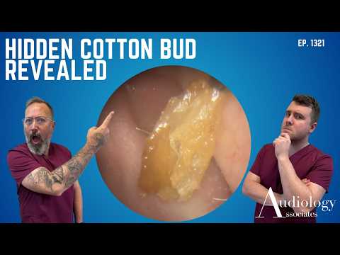 Hidden Cotton Bud Mistaken for Wax – EP1321
