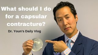 What Should I do for a Capsular Contracture? Dr. Youn's Daily Vlog