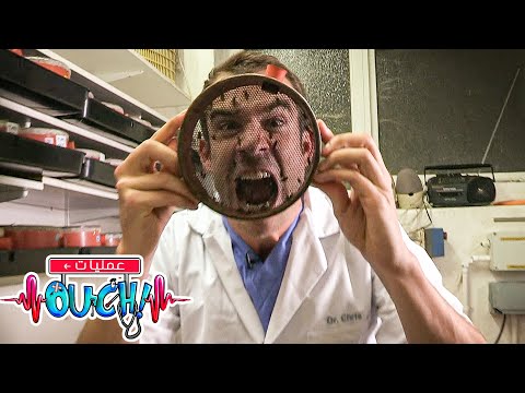 هل يمكن للحشرات أن تساعد في صنع الدواء أوبريشن آوتش 