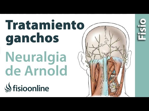 Video: Neuralgia Occipital: Gejala, Sebab, Dan Rawatan