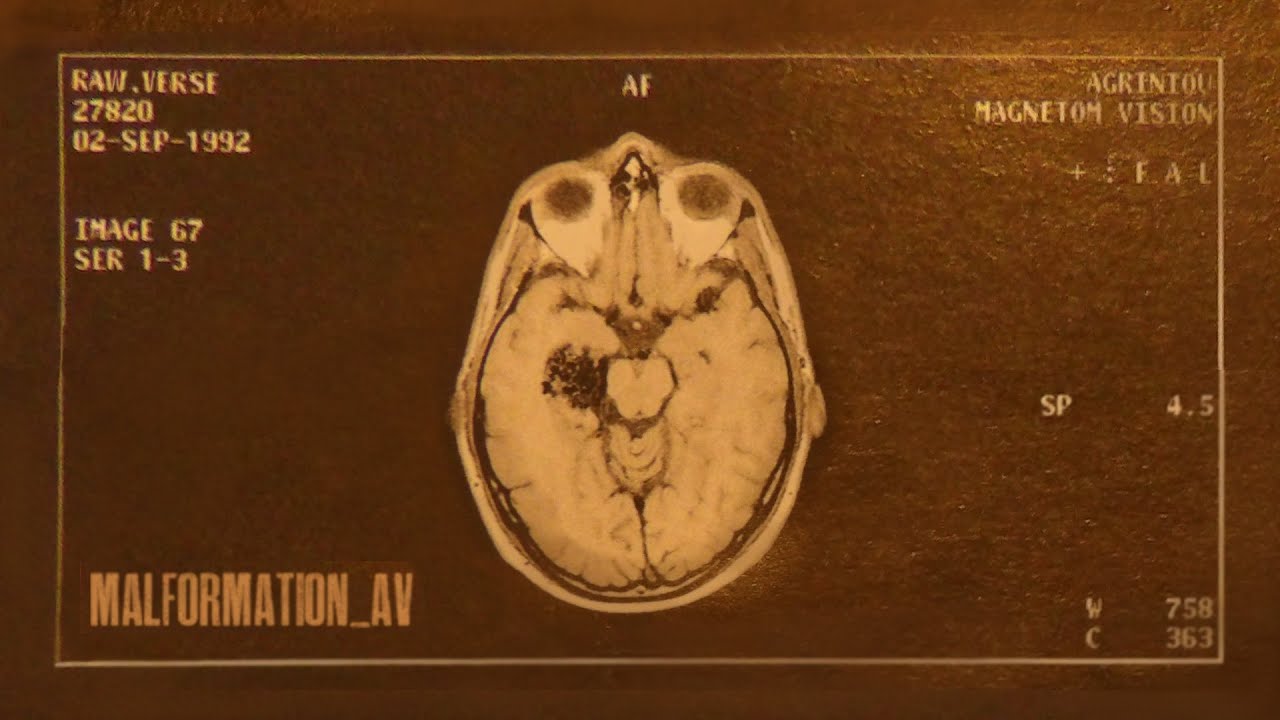 Raw Verse - Malformation_AV