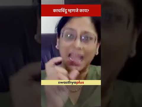 काचबिंदू म्हणजे काय? | What is Glaucoma? | Dr Shivani Sule | #Shorts