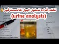 تعلم قراءه تحليل البول كالمحترفين (urine analysis)