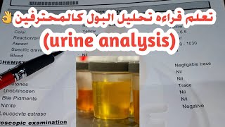 تعلم قراءه تحليل البول كالمحترفين (urine analysis)