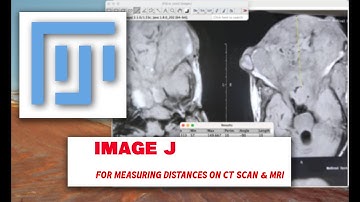 ImageJ for CT Scan and MRI