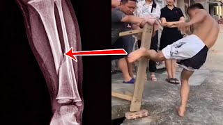 🔥Rural Kung Fu Boy, This Leg Has 20 Years Of Skill