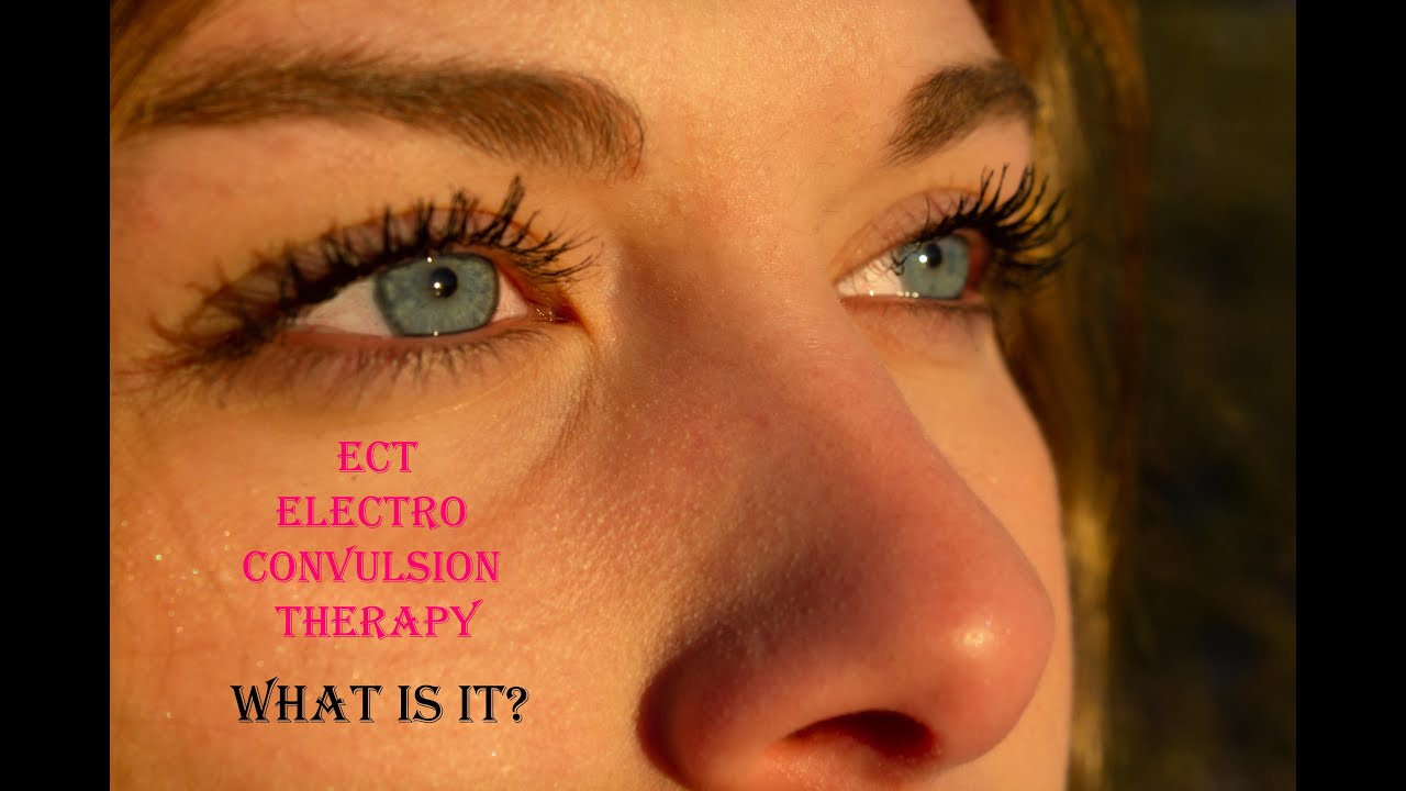 What Is Ect Electro Convulsion Therapy Youtube