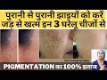             home remedies for hyperpigmentation