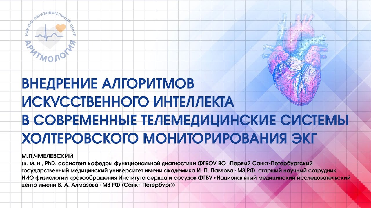 Внедрение алгоритмов ИИ в современные телемедицинские системы холтеровского мониторирования ЭКГ