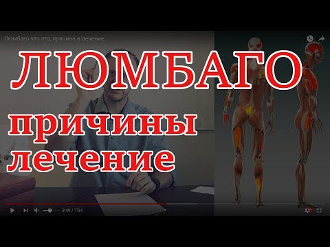 ЛЮМБАГО это | симптомы + лечение