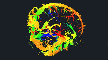 PRISM volume renderer