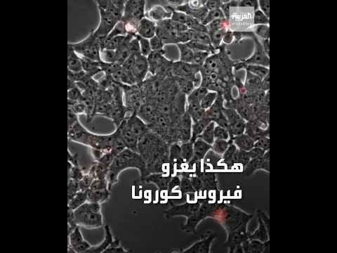 شاهد كيف يتسلل فيروس كورونا إلى خلايا دماغ خفاش وتحويل الخلايا إلى مصانع لصنع الفيروسات 