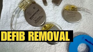 Download Lagu Removing defibrillators in the mortuary MP3