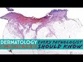 Dermatology Emergencies Every Pathologist Should Know