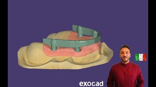 : EXOCAD - Barra