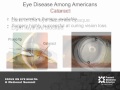 Focus on Eye Health: A National Summit - Vision Problems in the U.S.